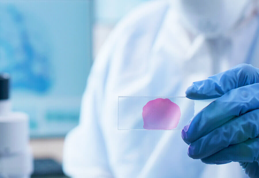 From Cytogenetics to Cytogenomics - Top 5 Reasons to Automate FFPE Tissue FISH Processing