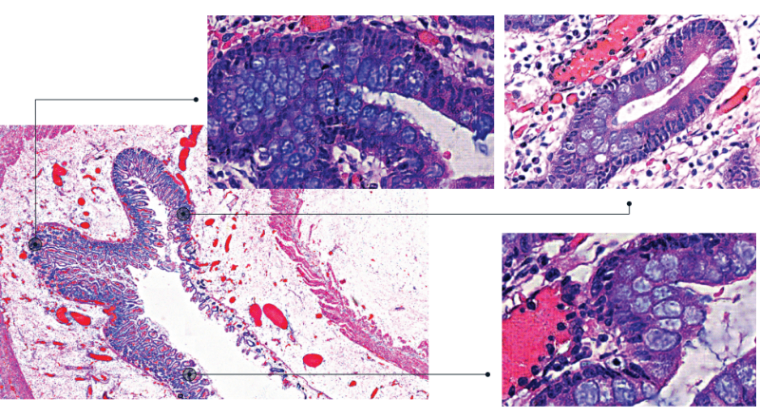人工智能驱动的高精度光学显微镜成像