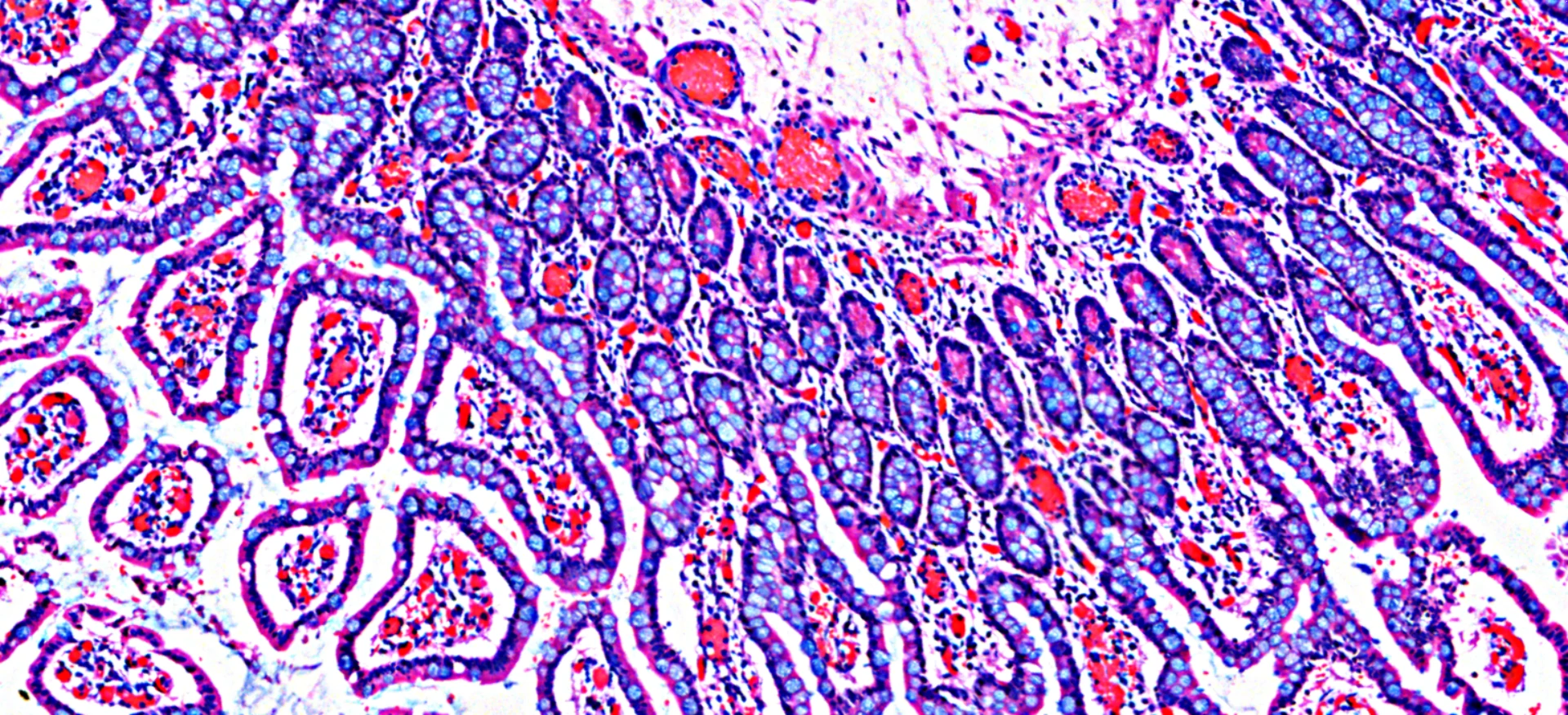 超高速，超清晰