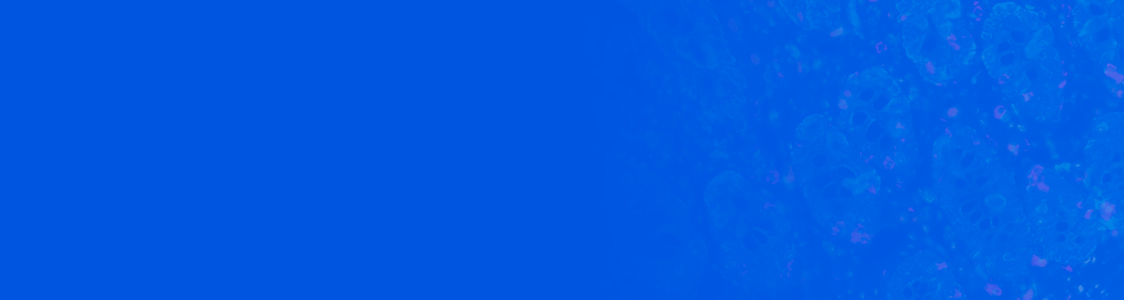 需要技术支持和服务吗？