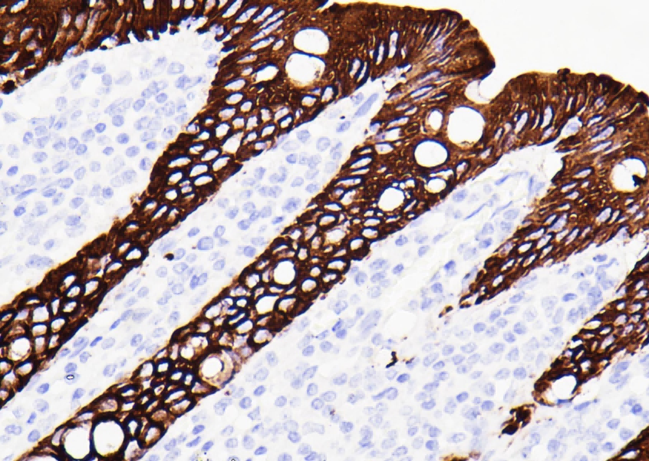 免疫显色试剂
（羊抗鼠/兔二抗-HRP）- EN