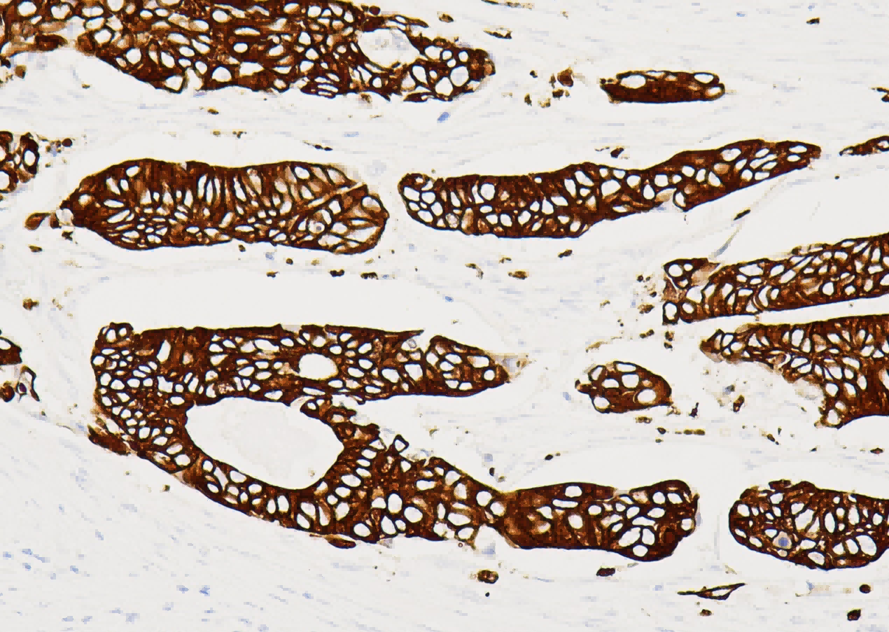 DAB染色液
（羊抗鼠/兔-HRP）