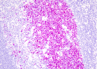 免疫显色试剂
（羊抗兔-AP）