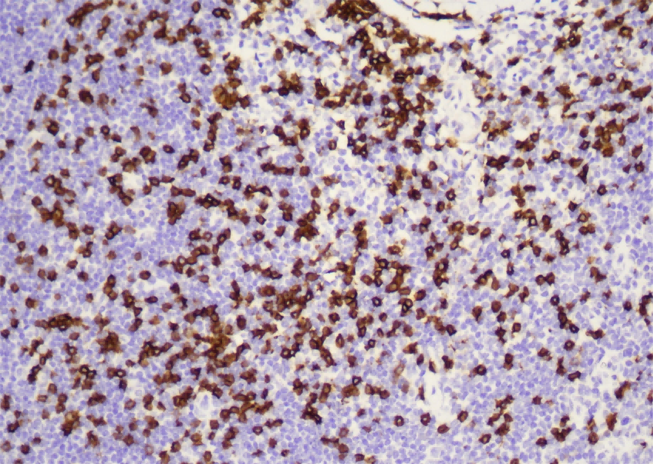 DAB染色液
（羊抗兔-HRP）