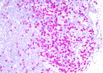 免疫显色试剂
（羊抗鼠/免-AP）