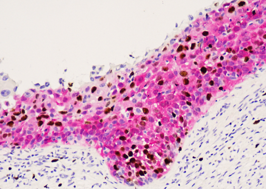 免疫显色试剂
（羊抗兔-HRP&羊抗鼠-AP）