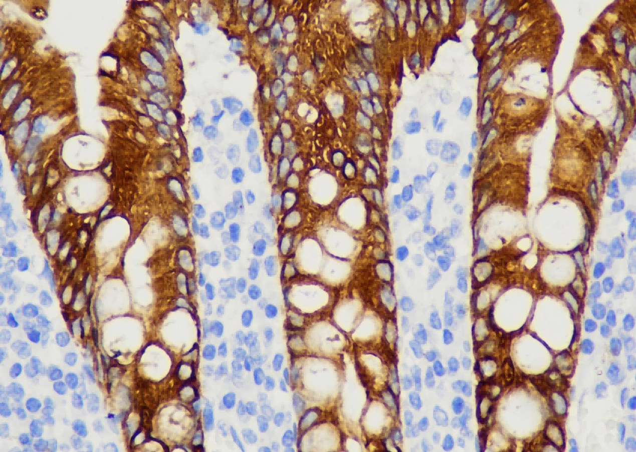 免疫显色试剂
（羊抗鼠/兔二抗-HRP）- HI