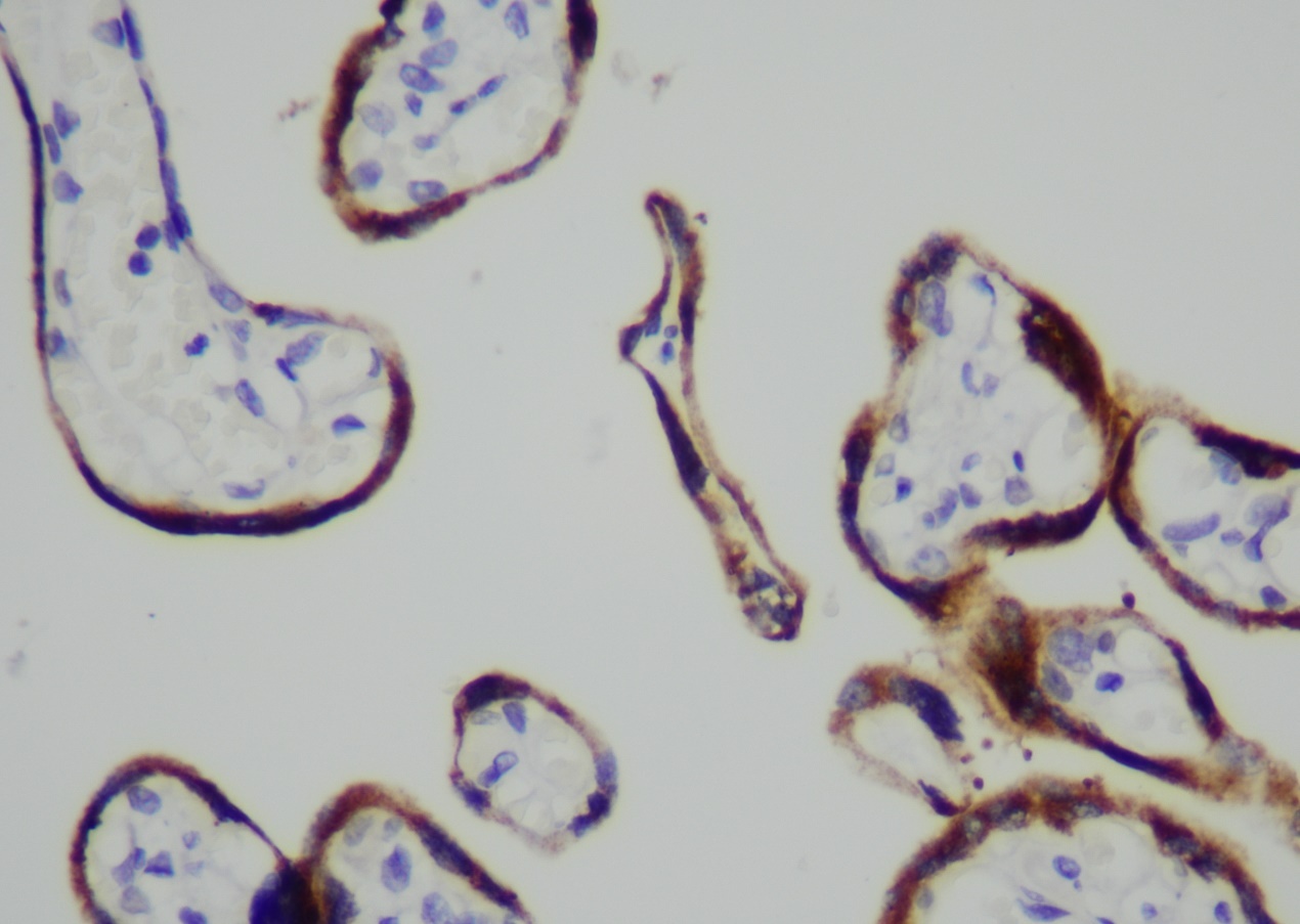 Human Chorionic Gonadotropin
