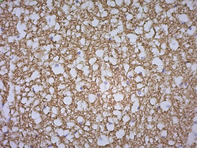 Myelin Basic Protein