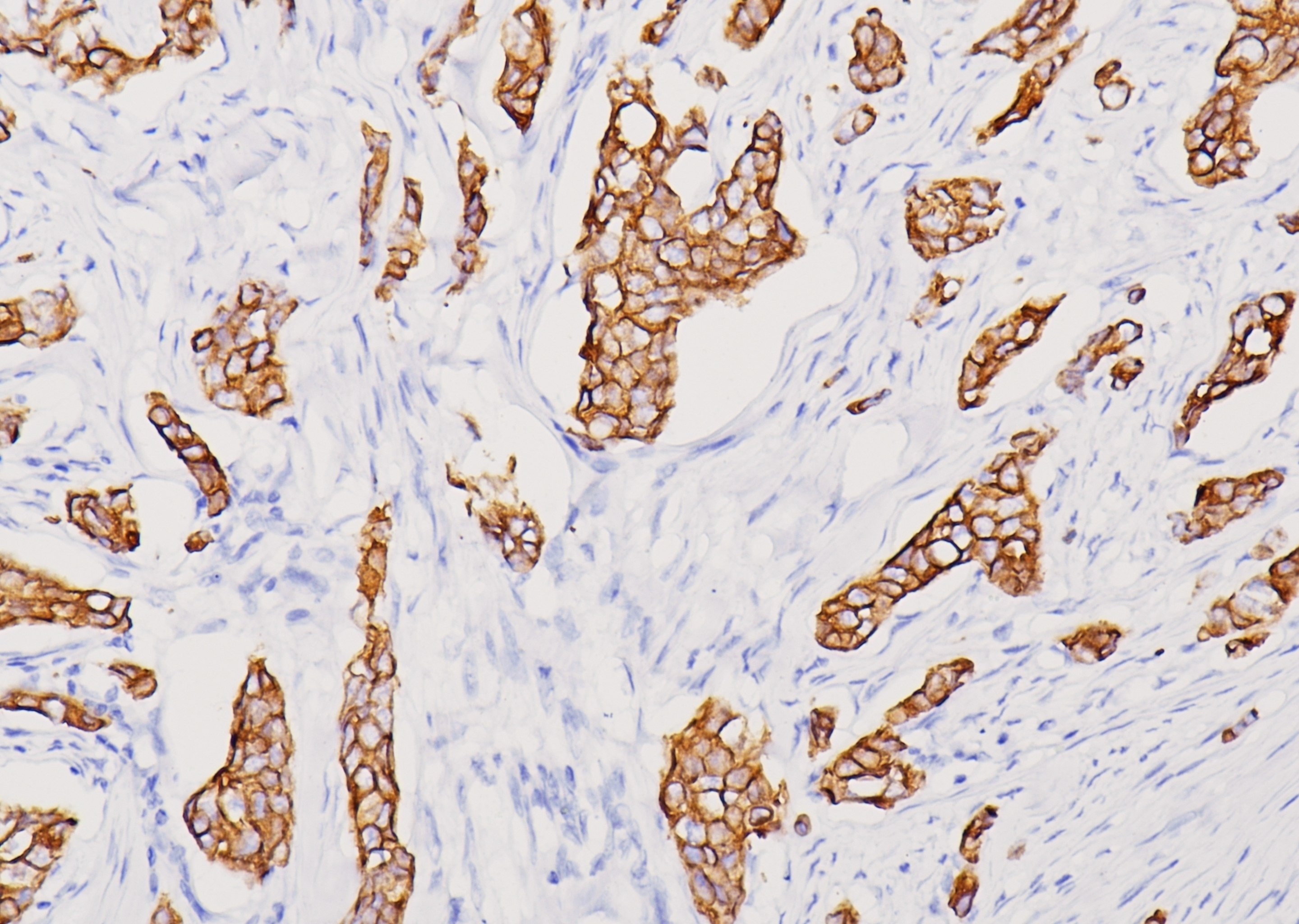细胞角蛋白（广谱）