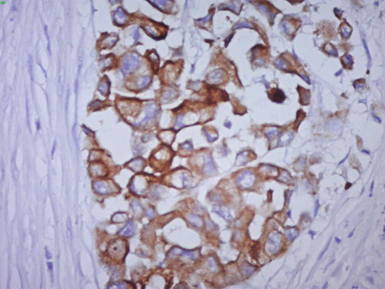 细胞角蛋白（低分子量）