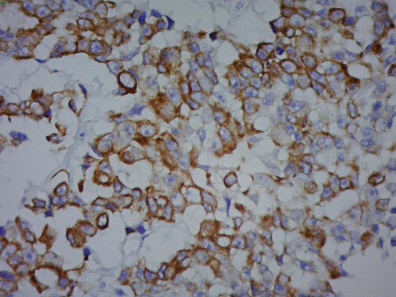 细胞角蛋白（高分子量）