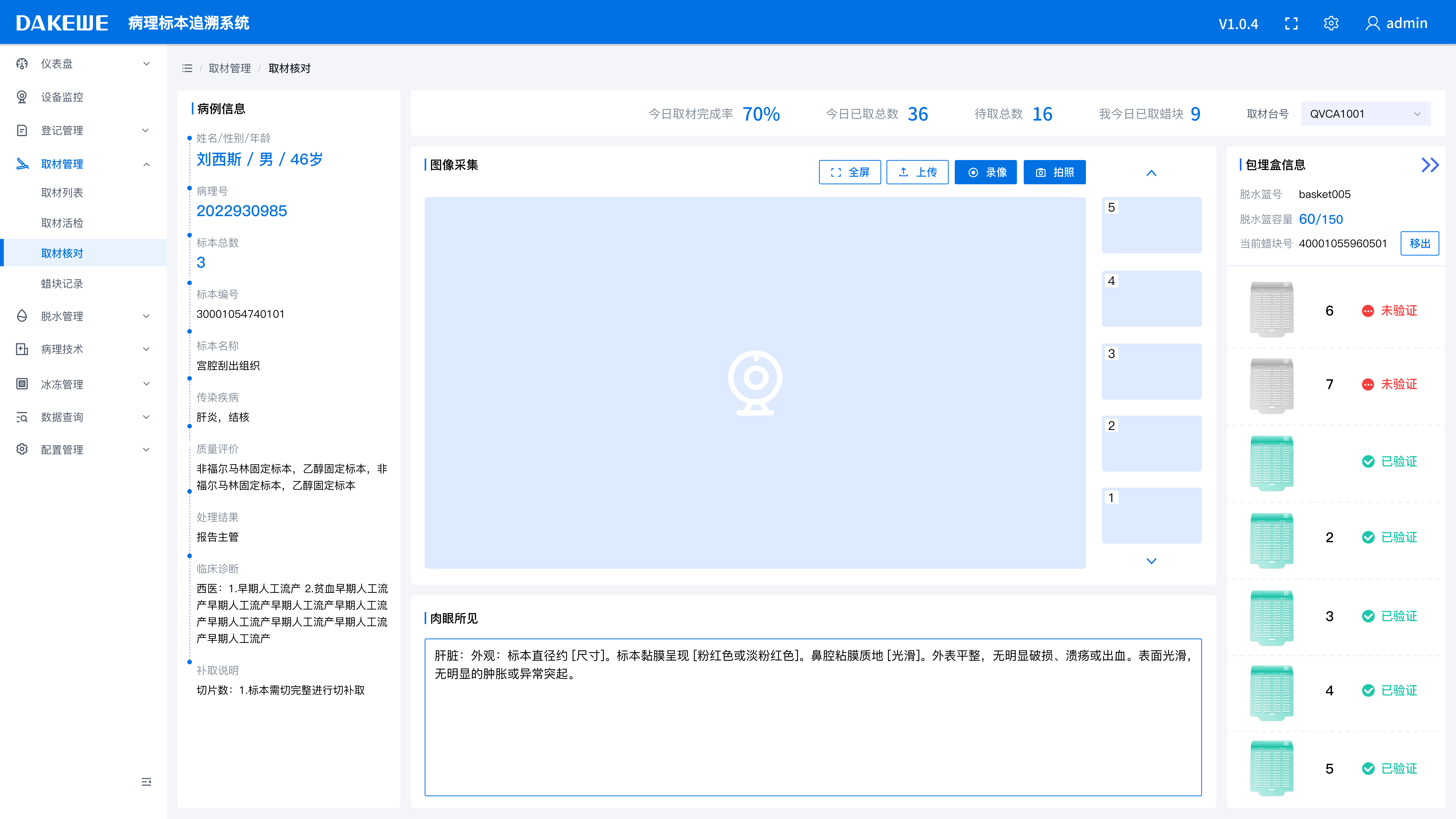 取材自动严格核对