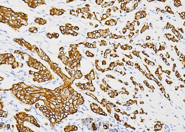 细胞角蛋白（广谱）
