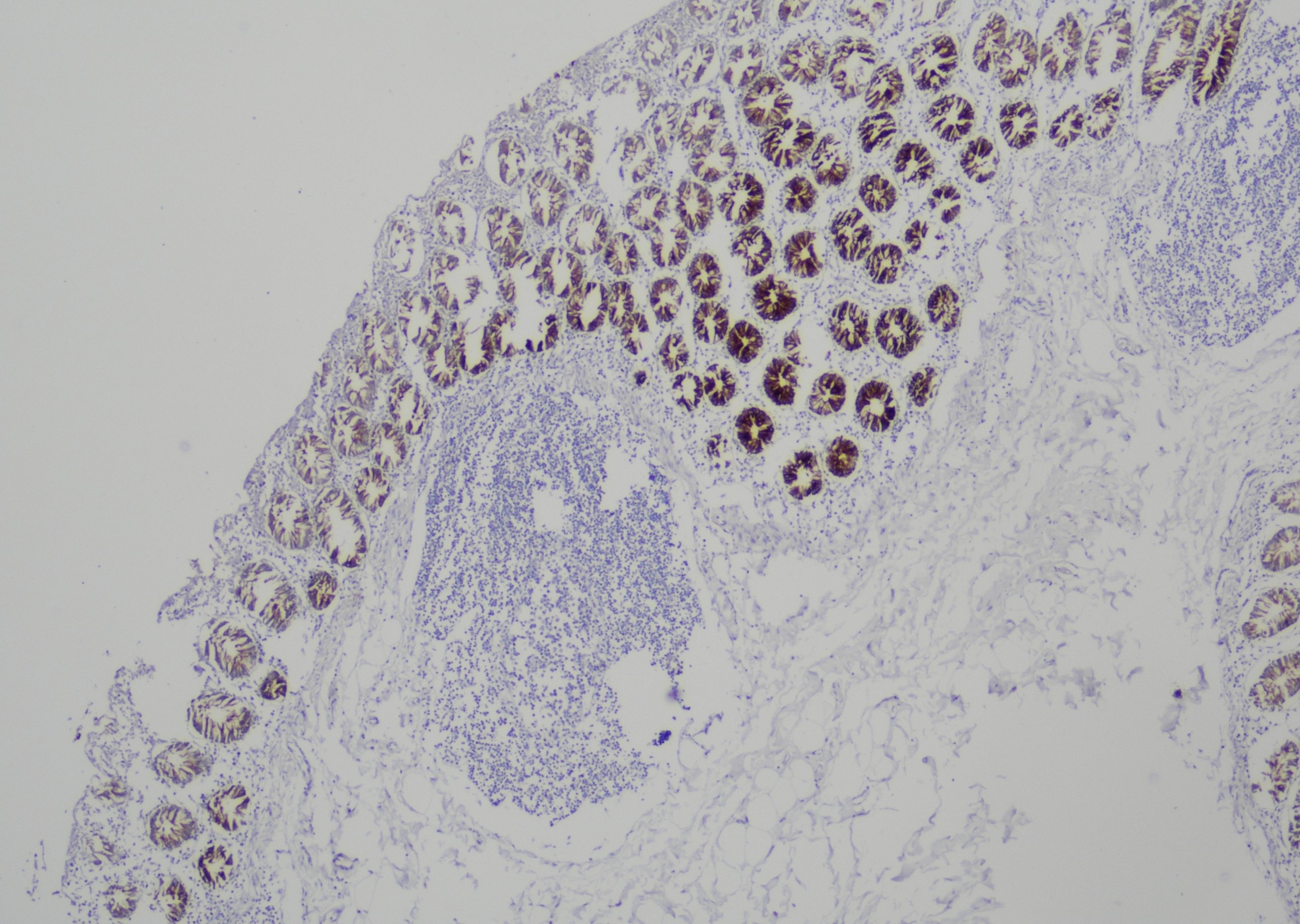 细胞角蛋白（低分子量）