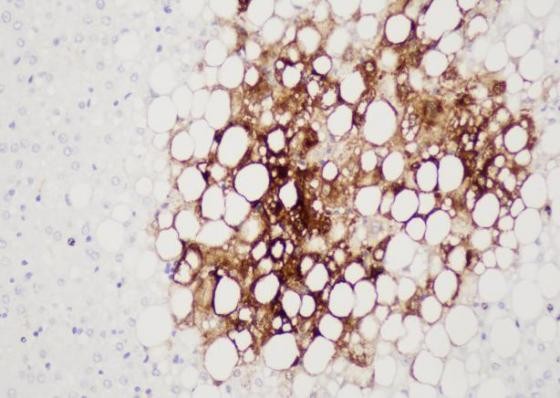 Glutamine Synthetase