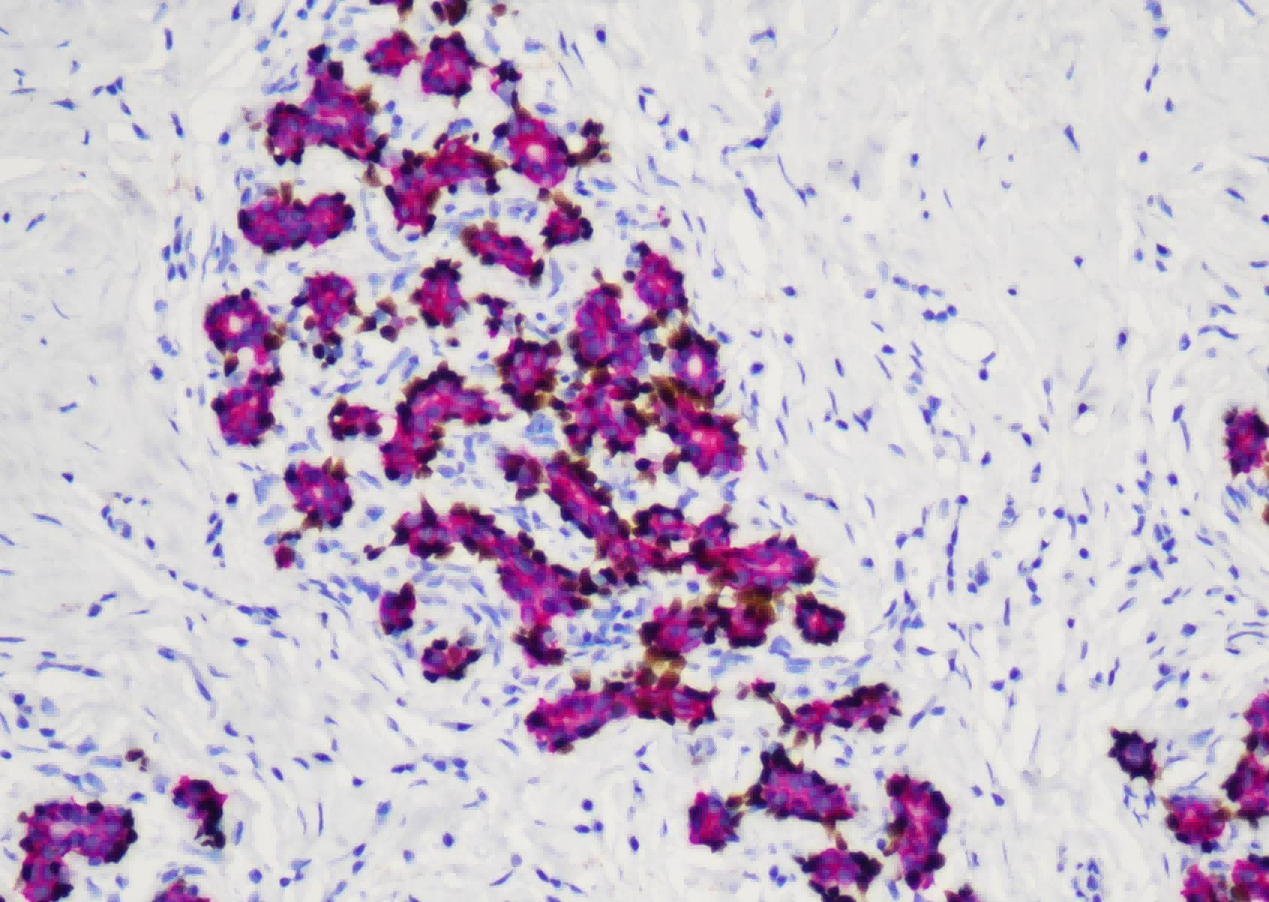 免疫显色试剂
（羊抗兔-HRP&羊抗鼠-AP）