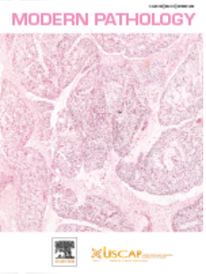 CIC重排间叶性肿瘤多组学特征