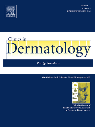 促纤维组织增生型黑色素瘤