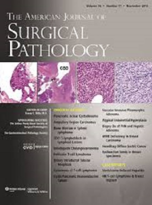 卵巢透明细胞癌中的早期病变