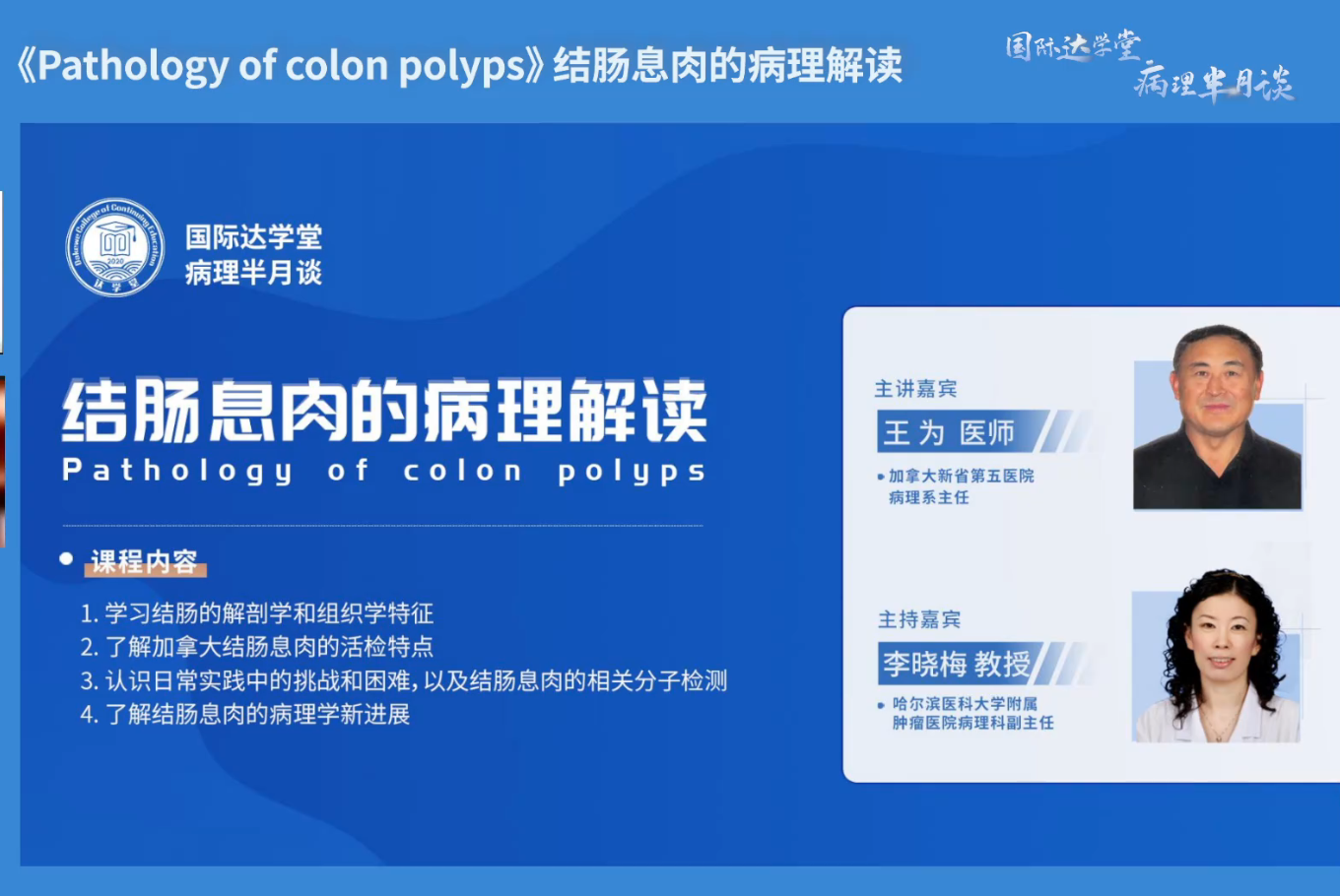 结肠息肉的病理解读